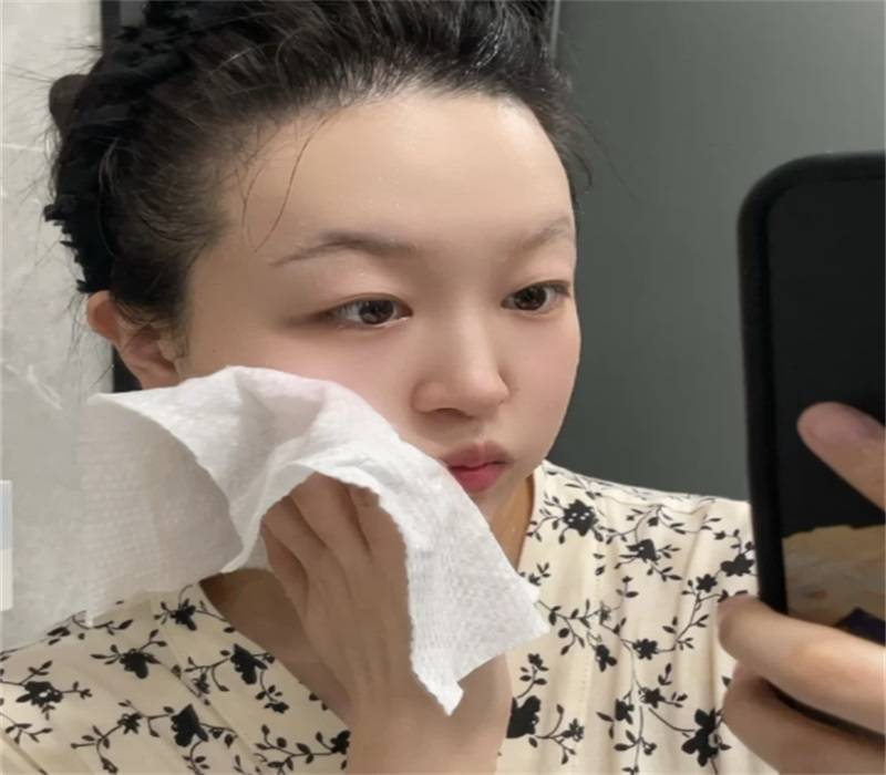 玫瑰痤瘡用什么卸妝比較好？深層潔凈不緊繃