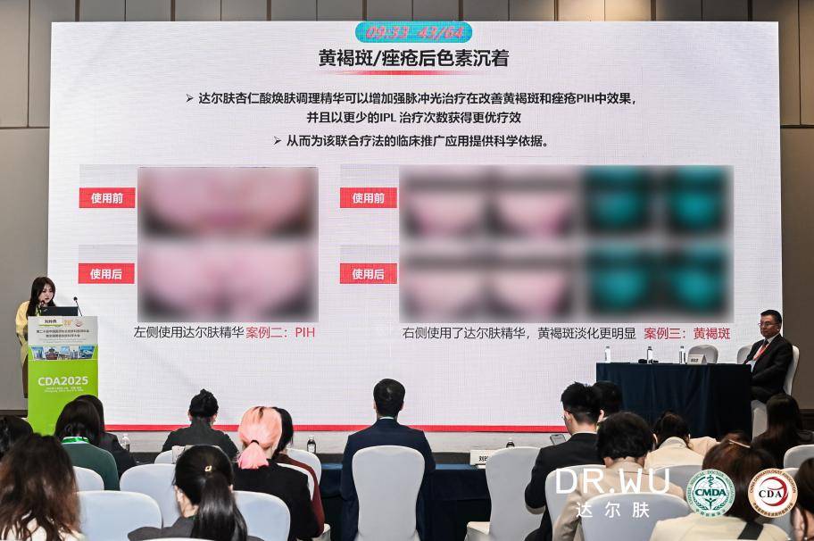 DR.WU達(dá)爾膚亮相CDA大會(huì) 第三屆痤瘡研究基金正式揭幕