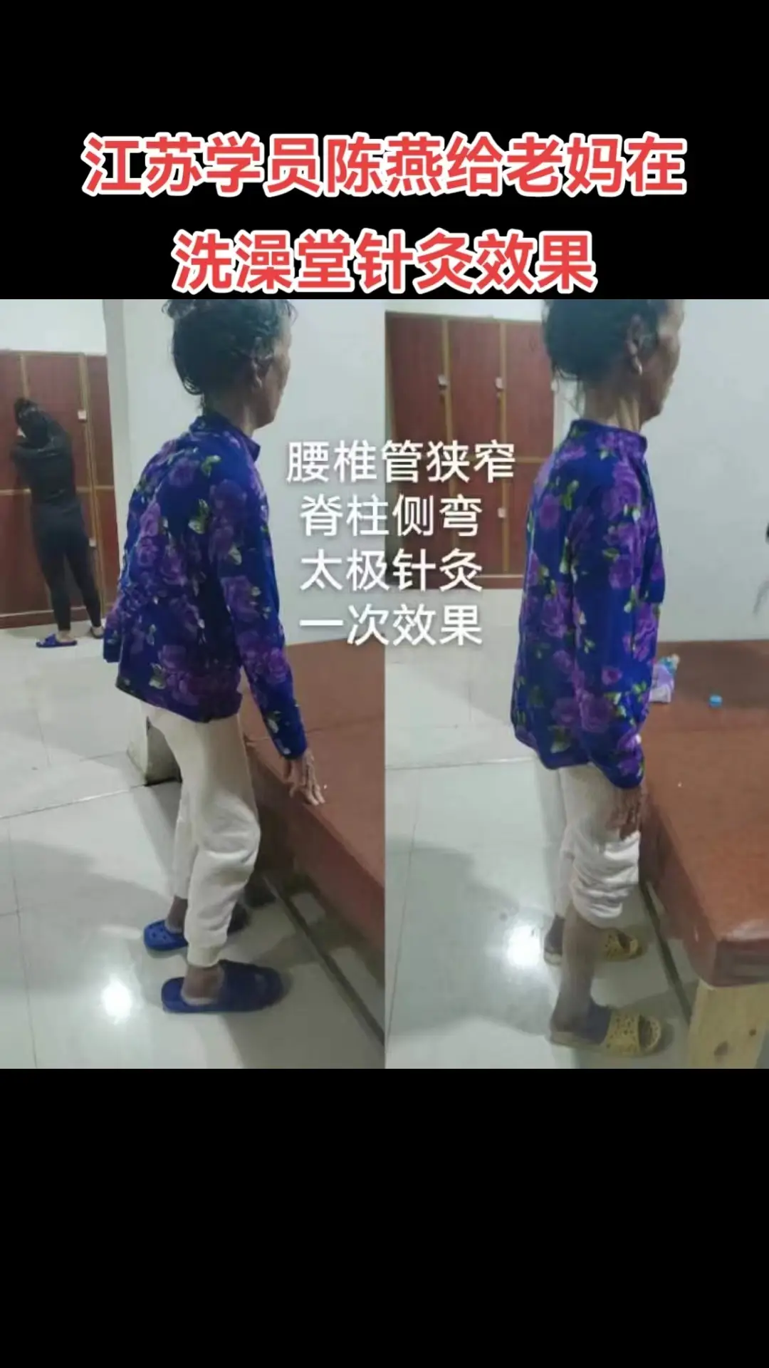 Top巨鹿內(nèi)病外治新療法學(xué)校：中醫(yī)按摩技術(shù)先驅(qū)者，推拿按摩中醫(yī)/足療按摩全流程方案提供者