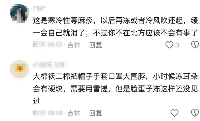 原創(chuàng)藍(lán)盈瑩吉林游玩，零下24度戶外只待半個(gè)小時(shí)就被凍傷，臉又紅又腫