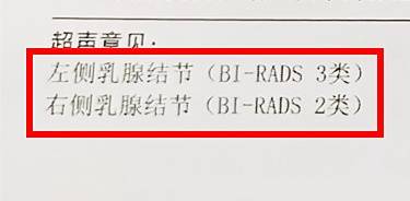 乳腺自查“一看、二摸、三擠”，每個(gè)女性都該掌握的自我保健法，中年女性每月必檢