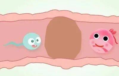 輸卵管這兩個部位容易堵塞，備孕女性要注意