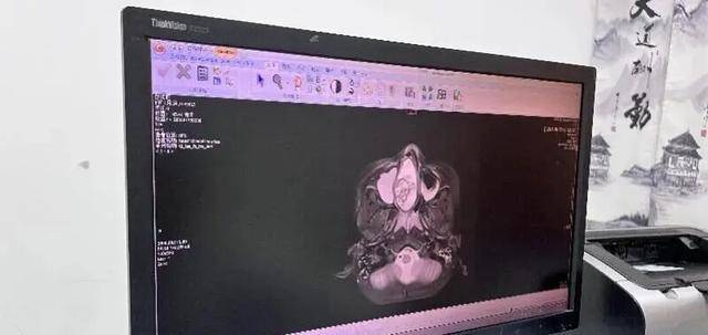 男童日本旅游期間突發(fā)不適劇痛難忍，緊急回國(guó)確診罕見(jiàn)疾病