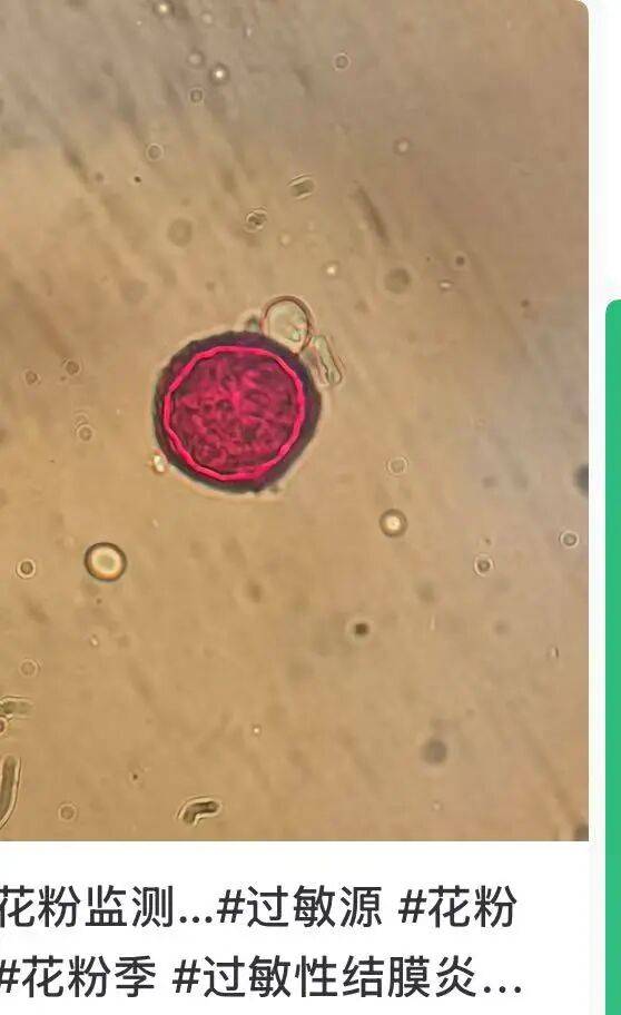 戴口罩！關(guān)閉門(mén)窗！今年提前“殺到”，多人中招！深圳網(wǎng)友：臉都腫了