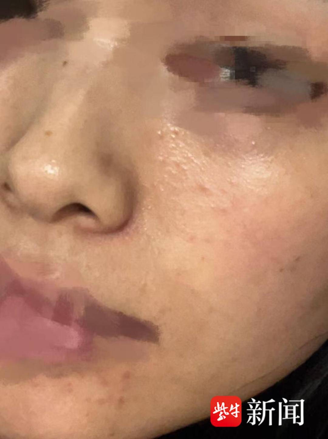 【3·15維權(quán)直通車】“閨蜜局”還是美麗陷阱？泗陽(yáng)一“店中店”美容會(huì)所致顧客難維權(quán)