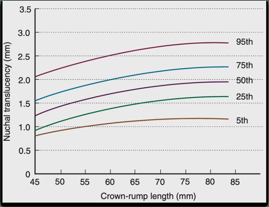 逸仙科普 | NT檢查全攻略，新手孕媽收藏不踩坑